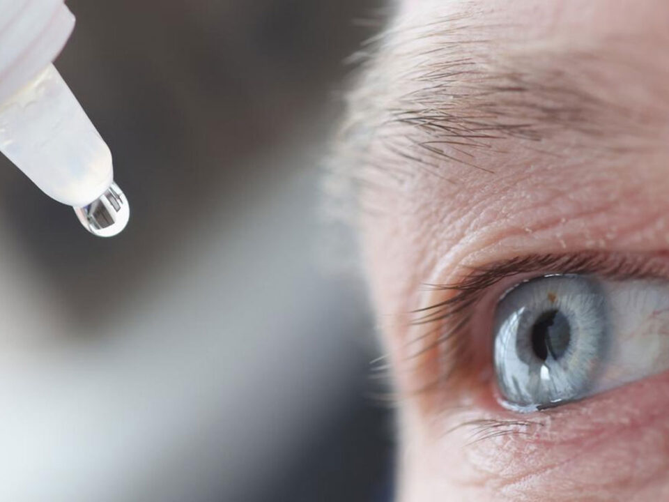 Understanding and Treating Dry Eye Syndrome