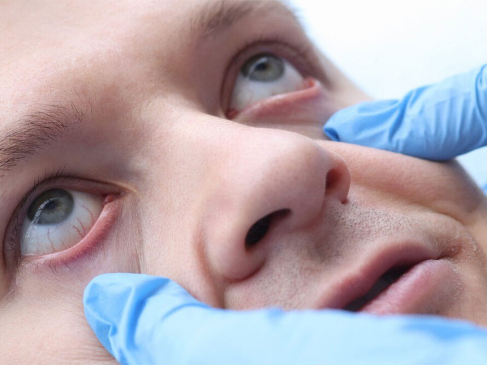 What to Do During an Ocular Emergency